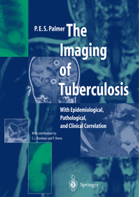 Produktbild: The Imaging of Tuberculosis