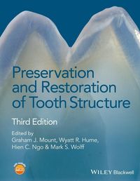 Produktbild: Preservation and Restoration of Tooth Structure