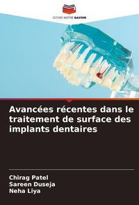 Produktbild: Avanc&eacute;es r&eacute;centes dans le traitement de surface des implants dentaires