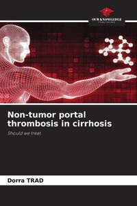 Produktbild: Non-tumor portal thrombosis in cirrhosis
