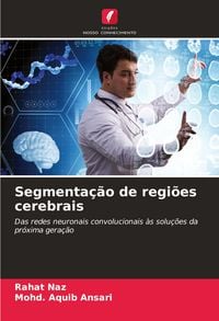 Produktbild: Segmenta&ccedil;&atilde;o de regi&otilde;es cerebrais