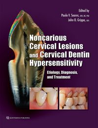 Produktbild: Noncarious Cervical Lesions and Cervical Dentin Hypersensitivity
