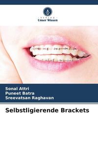 Produktbild: Selbstligierende Brackets