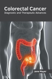 Produktbild: Colorectal Cancer: Diagnostic and Therapeutic Advances