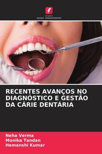 Produktbild: Recentes Avan&ccedil;os No Diagn&oacute;stico E Gest&atilde;o Da C&aacute;rie Dent&aacute;ria