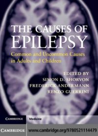 Produktbild: Causes of Epilepsy