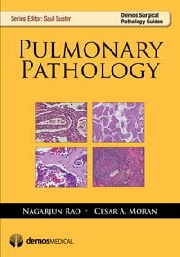 Produktbild: Rao, R: Pulmonary Pathology