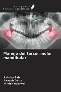 Produktbild: Manejo del tercer molar mandibular