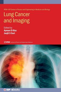 Produktbild: Lung Cancer and Imaging