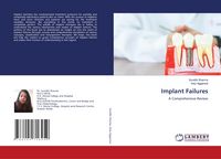 Produktbild: Implant Failures