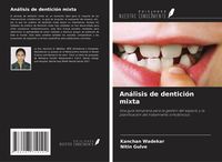 Produktbild: An&aacute;lisis de dentici&oacute;n mixta