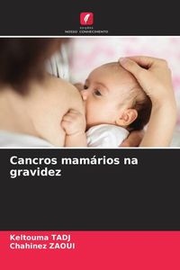 Produktbild: Cancros mam&aacute;rios na gravidez