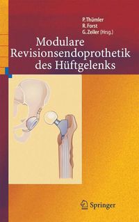 Produktbild: Modulare Revisionsendoprothetik des H&uuml;ftgelenks