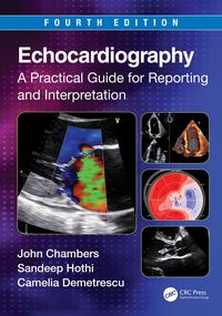 Produktbild: Echocardiography