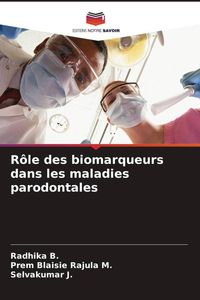Produktbild: R&ocirc;le des biomarqueurs dans les maladies parodontales