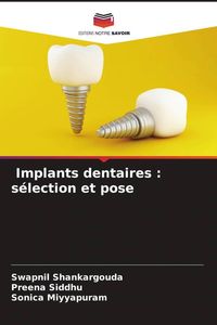 Produktbild: Implants dentaires : s&eacute;lection et pose