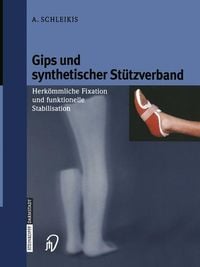 Produktbild: Gips und synthetischer St&uuml;tzverband
