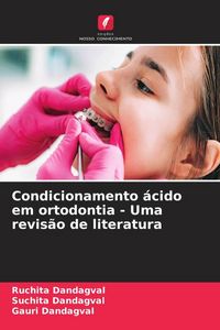 Produktbild: Condicionamento &aacute;cido em ortodontia - Uma revis&atilde;o de literatura