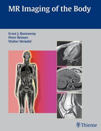 Produktbild: MR Imaging of the Body