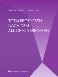 Produktbild: Totalprothesen nach dem All-Oral-Verfahren