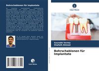 Produktbild: Bohrschablonen f&uuml;r Implantate
