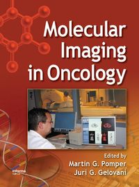 Produktbild: Molecular Imaging in Oncology