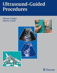 Produktbild: Ultrasound-Guided Procedures