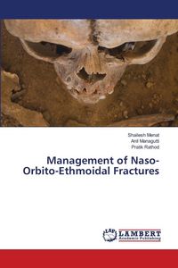 Produktbild: Management of Naso-Orbito-Ethmoidal Fractures