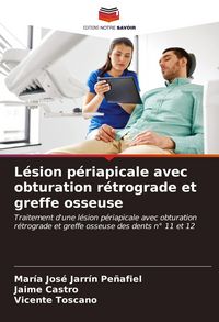 Produktbild: L&eacute;sion p&eacute;riapicale avec obturation r&eacute;trograde et greffe osseuse