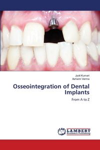 Produktbild: Osseointegration of Dental Implants