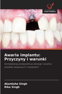 Produktbild: Awaria implantu: Przyczyny i warunki