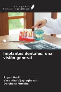 Produktbild: Implantes dentales: una visi&oacute;n general