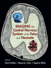 Produktbild: Imaging the Central Nervous System of the Fetus and Neonate