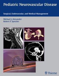 Produktbild: Pediatric Neurovascular Disease