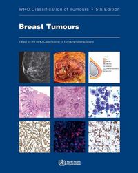 Produktbild: Breast Tumours