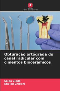 Produktbild: Obtura&ccedil;&atilde;o ort&oacute;grada do canal radicular com cimentos biocer&acirc;micos