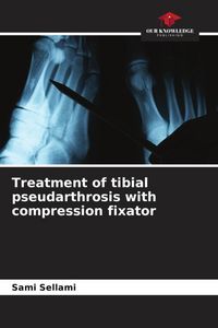 Produktbild: Treatment of tibial pseudarthrosis with compression fixator