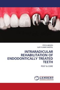 Produktbild: Intraradicular Rehabilitation Of Endodontically Treated Teeth