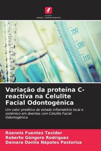 Produktbild: Varia&ccedil;&atilde;o da prote&iacute;na C-reactiva na Celulite Facial Odontog&eacute;nica
