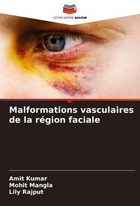 Produktbild: Malformations vasculaires de la r&eacute;gion faciale