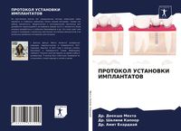 Produktbild: Protokol Ustanovki Implantatov