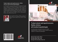Produktbild: Tubercolosi extrapolmonare. Dalla clinica all'anatomopatologia