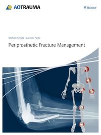 Produktbild: Periprosthetic Fracture Management