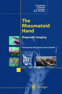 Produktbild: The Rheumatoid Hand: Diagnostic Imaging