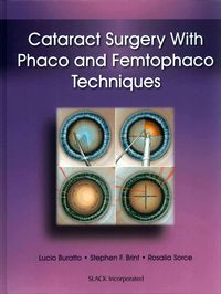Produktbild: Cataract Surgery With Phaco and Femtophaco Techniques