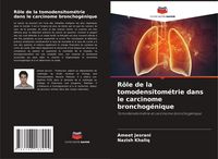 Produktbild: R&ocirc;le de la tomodensitom&eacute;trie dans le carcinome bronchog&eacute;nique