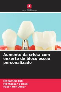 Produktbild: Aumento da crista com enxerto de bloco &oacute;sseo personalizado
