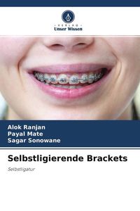 Produktbild: Selbstligierende Brackets