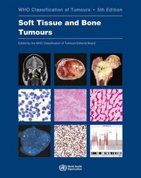 Produktbild: Soft Tissue and Bone Tumours