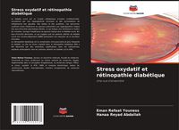 Produktbild: Stress oxydatif et r&eacute;tinopathie diab&eacute;tique
